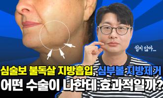 심술보 불독살 지방흡입, 심부볼 지방제거, 어떤 수술이 나한테 효과적일까?