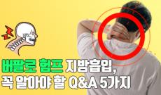 버팔로 험프 지방흡입, 꼭 알아야 할 Q&A 5가지