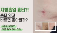 지방흡입 흉터?! 흉터 연고 바르면 좋아질까?