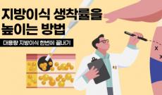  지방이식 생착률 높이기 (대용량 지방이식 한번에 끝내기)