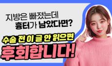 얼굴지방흡입 수술 비용 및 흉터 안내 (위치, 크기, 갯수)