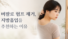 버팔로 험프 제거, 지방흡입을 추천하는 이유