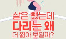 다리지방흡입 효과, 하체가 길어 보이려면