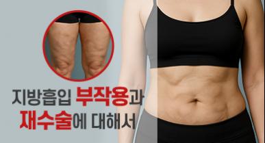 지방흡입 부작용과 재수술