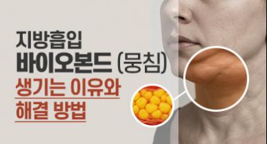 지방흡입 바이오본드, 유착과 회복에 대해 꼭 알아야 할 것들