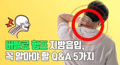 버팔로 험프 지방흡입, 꼭 알아야 할 Q&A 5가지