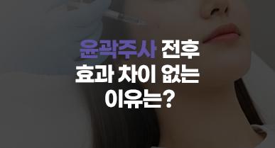윤곽주사 전후 효과 차이 없는 이유는?