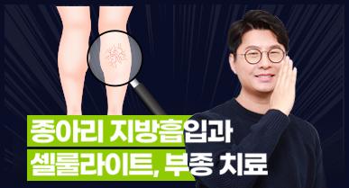 종아리 지방흡입과 셀룰라이트, 부종 치료 방법