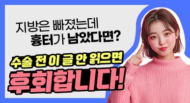 얼굴지방흡입 수술 비용 및 흉터 안내 (위치, 크기, 갯수)