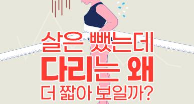 다리지방흡입 효과, 하체가 길어 보이려면