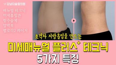 초격차 지방흡입을 만드는 미세매뉴얼 플러스+ 테크닉 5가지 특징