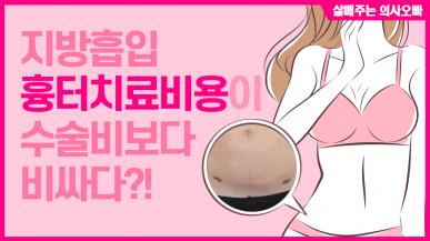 수술비보다 더 비싼 흉터 치료비?