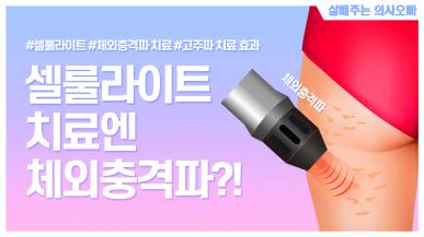 셀룰라이트를 줄일 수 있는 가장 효과적인 방법