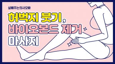지방흡입 후 붓기와 바이오본드 빨리 푸는 방법