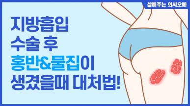 지방흡입 부작용? 빨간 피부(홍반)와 물집 관리 방법