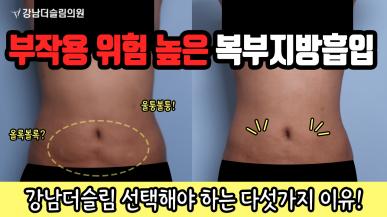 복부지방흡입 부작용 걱정 된다면