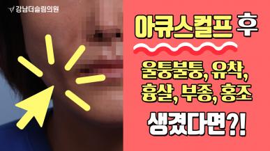 아큐스컬프 부작용 이렇게 치료해야 합니다.