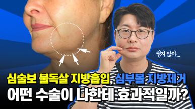 심술보 불독살 지방흡입, 심부볼 지방제거, 어떤 수술이 나한테 효과적일까?