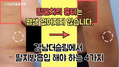 팔지방흡입 시 팔꿈치의 흉터는 평생 없어지지 않습니다