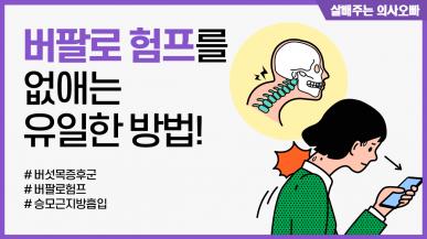 버팔로 험프를 없애는 유일한 방법?