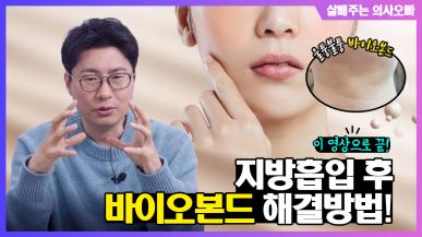 지방흡입 후 바이오본드 해결 방법 이 영상으로 끝!