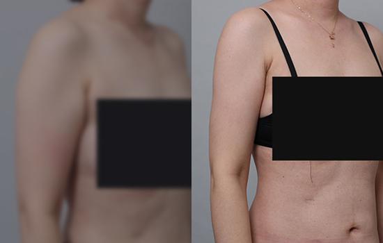 161cm/54.2kg/팔미니/650cc/6개월