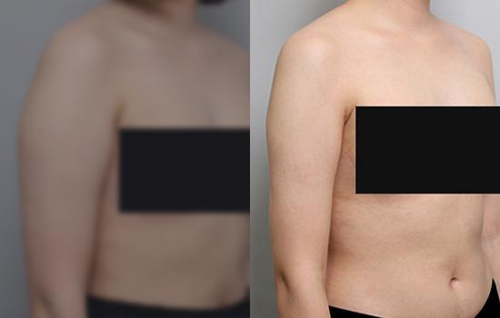164cm/55.8kg/팔/1100cc/4개월