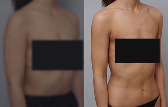 160cm/54.3kg/팔미니/400cc/5개월