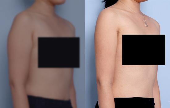 164.5cm/50.4kg/팔/1100cc/1개월