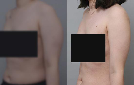 157cm/55.5kg/팔/1300cc/1개월