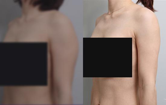 157cm/51.8kg/마른팔/650cc/7개월