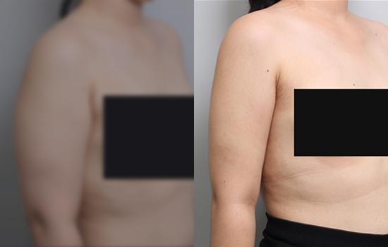168cm/69.1kg/팔/1500cc/1개월