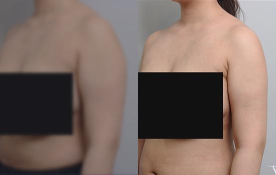 160cm/60kg/팔/1600cc/7개월