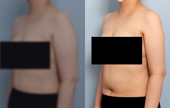168cm/70.3kg/팔/1800cc/1개월