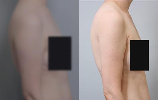 158cm/47kg/팔(브래지어라인)/900cc/7개월