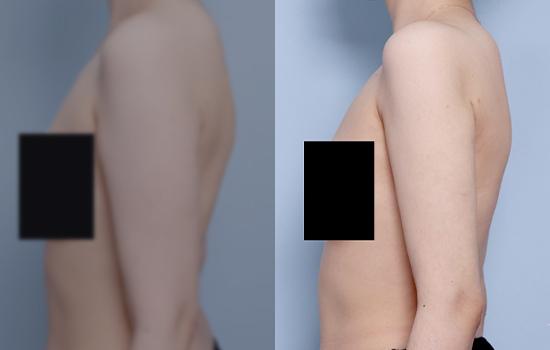 169cm/56.9kg/팔/850cc/1개월