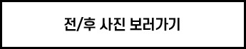 전후사진 보러가기