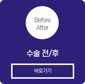 전후사진 보러가기