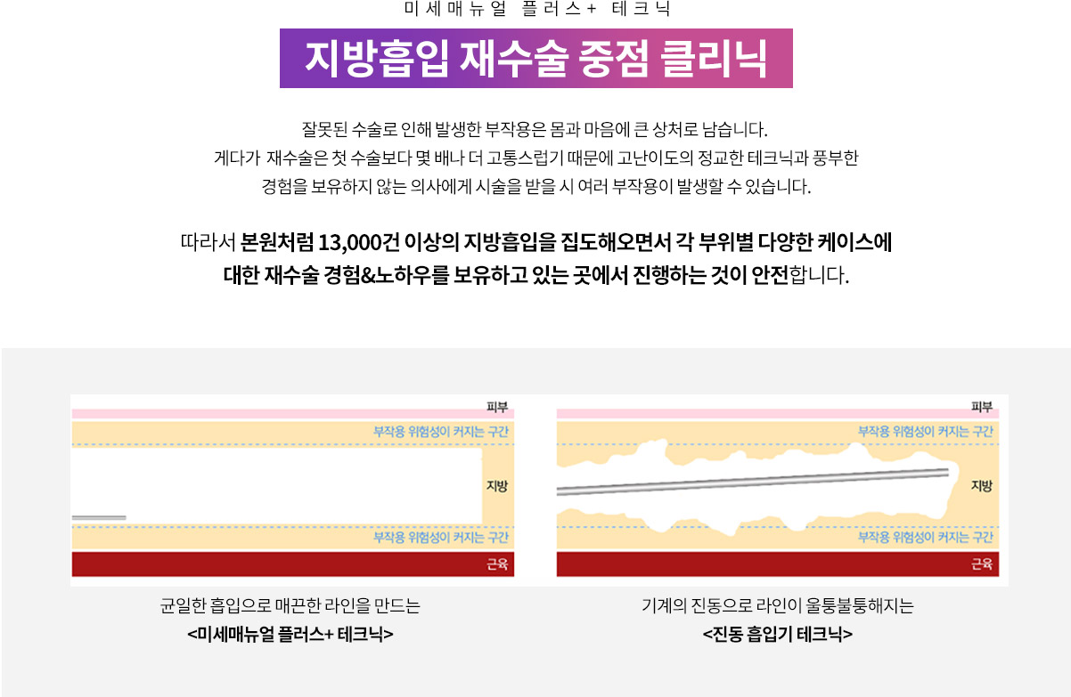강남더슬림의원에서 만날 수 있는 지방흡입 재수술 중점 클리닉